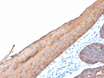 Recombinant Type I Cytokeratin Antibody (CK10/14/15/16/19)
