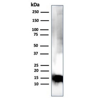 Myelin Basic Protein Antibody