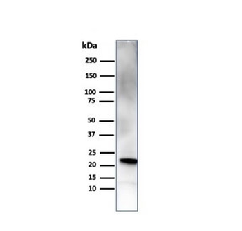 RBP4 Antibody / Retinol Binding Protein 4