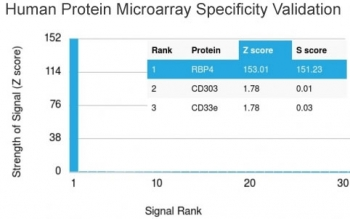 RBP4 Antibody / Retinol Binding Protein 4