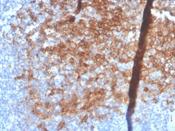 Recombinant Syndecan-1 Antibody / CD138