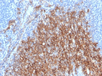Recombinant Syndecan-1 Antibody / CD138