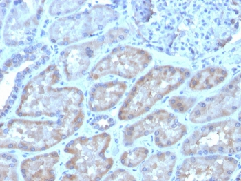 FGF23 Antibody / Fibroblast Growth Factor 23
