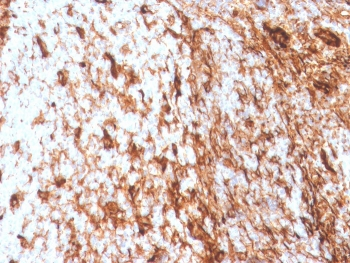 Recombinant Vimentin Antibody