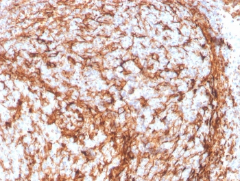 Recombinant Vimentin Antibody