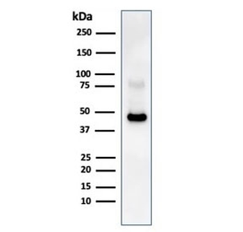 Recombinant CD38 Antibody