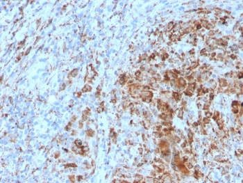 TIM3 Antibody / HAVCR2