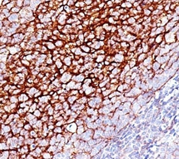 CD35 Antibody (Complement Receptor 1)
