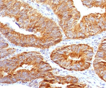 TNFSF15 Antibody / VEGI / TL1A