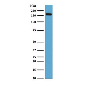 Topoisomerase II alpha Antibody / TOP2A