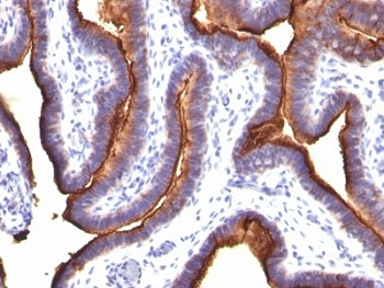 EMA Antibody / MUC1 / Mucin-1