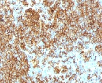 CD45RB Antibody (B-cell marker)