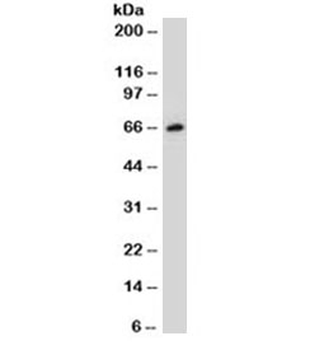 ER Antibody / Estrogen Receptor alpha