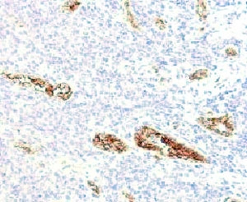 von Willebrand Factor Antibody