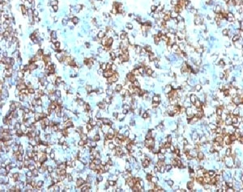 HLA-DRB1 Antibody (MHC II)