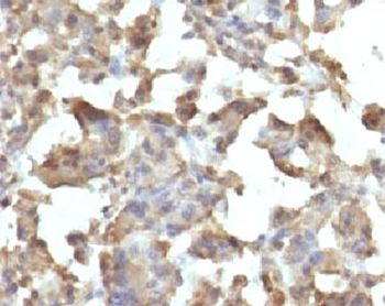 TNF alpha Antibody