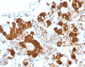 ACTH Antibody / CLIP