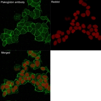 Plakoglobin Antibody / Gamma Catenin