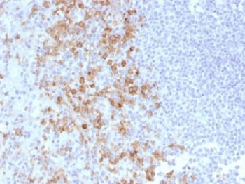 PSGL-1 Antibody / CD162