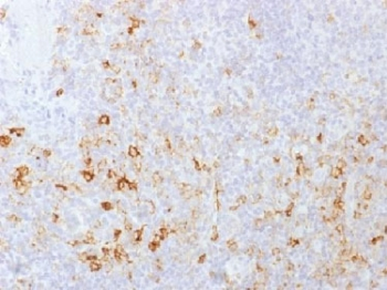 PSGL-1 Antibody / CD162