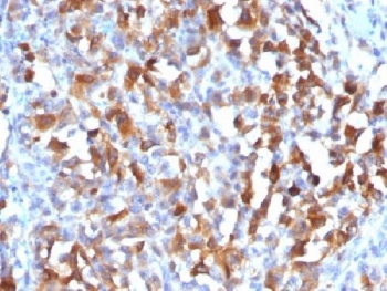 MART-1 Antibody / Melan-A