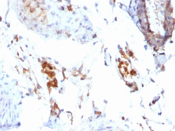 Ferritin Light Chain Antibody