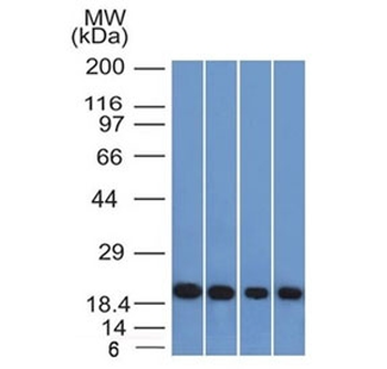 Ferritin Light Chain Antibody