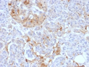 Ferritin Light Chain Antibody