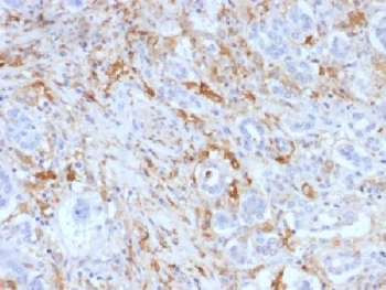 Ferritin Light Chain Antibody