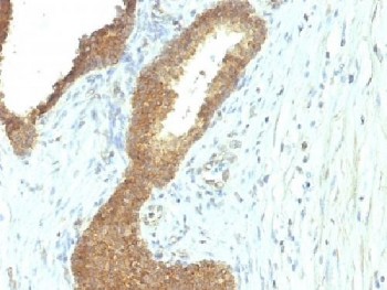 Alkaline Phosphatase Antibody (tissue-nonspecific)