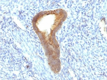 Alkaline Phosphatase Antibody (tissue-nonspecific)