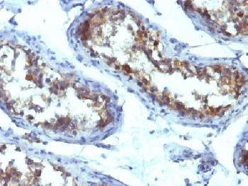 Alkaline Phosphatase Antibody (tissue-nonspecific)