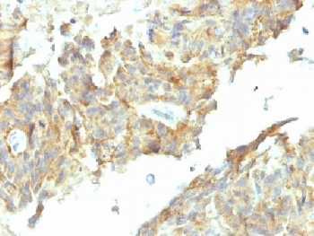 Alkaline Phosphatase Antibody (tissue-nonspecific)