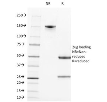Alkaline Phosphatase Antibody (tissue-nonspecific)