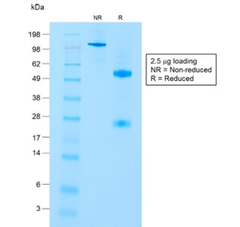 Recombinant CD8 Antibody (alpha chain) / Rabbit Monoclonal