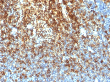 Recombinant CD43 Antibody / Rabbit Monoclonal