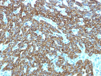 Recombinant Basic Cytokeratin Antibody / Rabbit Monoclonal