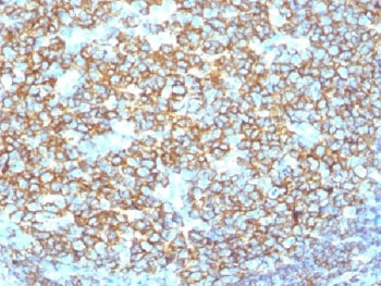 Recombinant CD20 Antibody / Rabbit Monoclonal