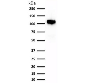 Recombinant Cadherin 16 Antibody / Rabbit Monoclonal
