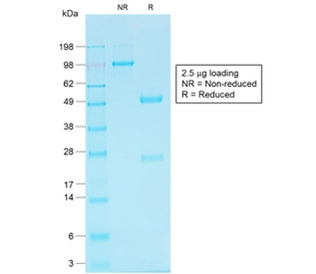 Recombinant Cadherin 16 Antibody / Rabbit Monoclonal