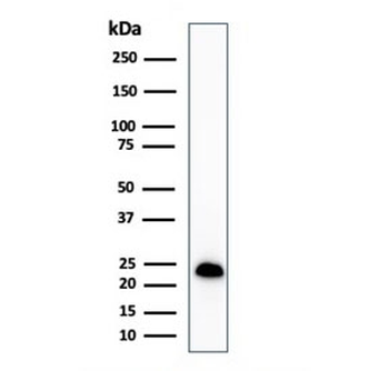 Recombinant MART-1 Antibody / Rabbit Monoclonal