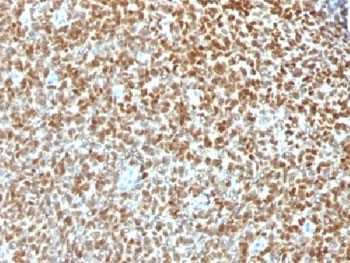 Recombinant NKX2.2 Antibody / Rabbit Monoclonal
