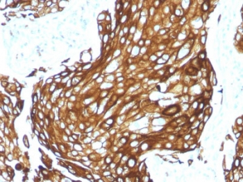 Recombinant Acidic Cytokeratin Antibody / Rabbit Monoclonal
