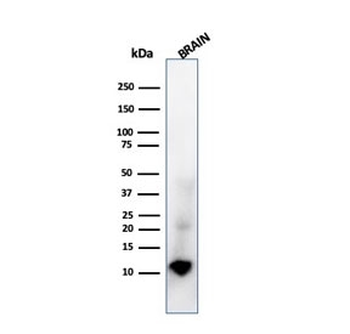 Recombinant S100B Antibody