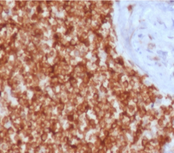 Recombinant Bcl-2 Antibody / Rabbit Monoclonal