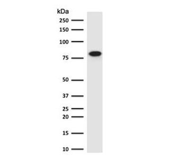 Recombinant Beta Catenin Antibody / Rabbit Monoclonal