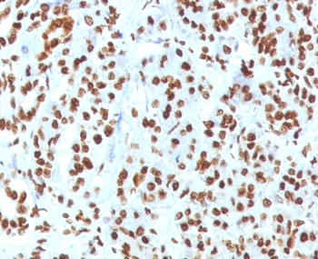 Recombinant Histone H1 Antibody / Rabbit Monoclonal