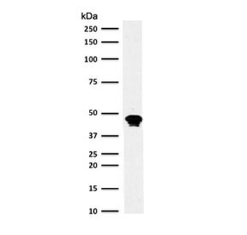 Recombinant CD79a Antibody / Rabbit Monoclonal