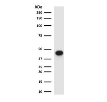 Recombinant EpCAM Antibody / Extracellular domain