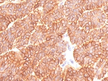 Recombinant EpCAM Antibody / Extracellular domain